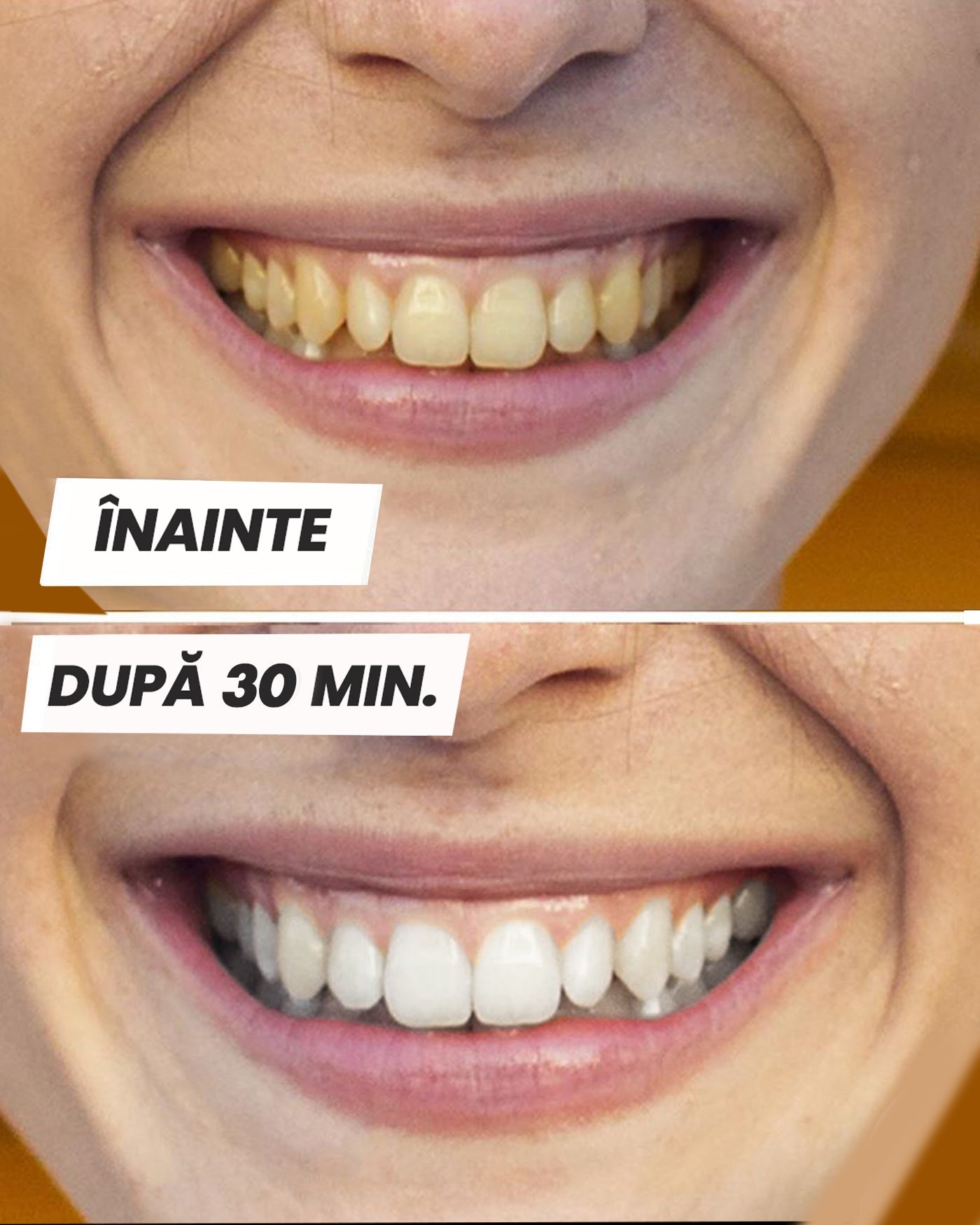 Benzi pentru Albirea Dinților