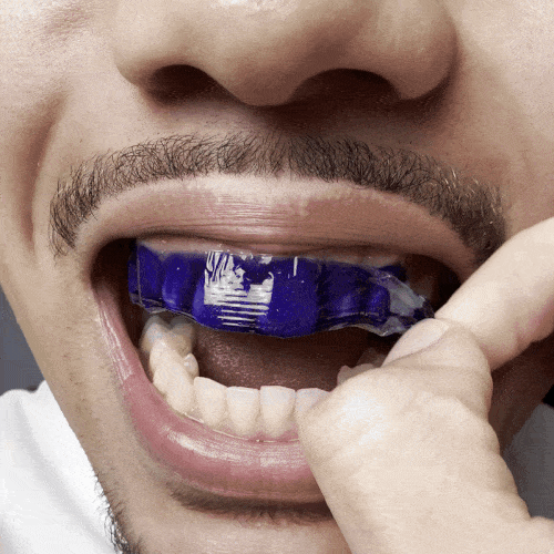 Benzi pentru Albirea Dinților